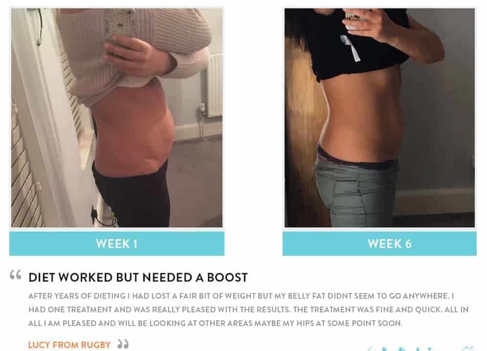 Before and After Dieting Newcastle upon Tyne