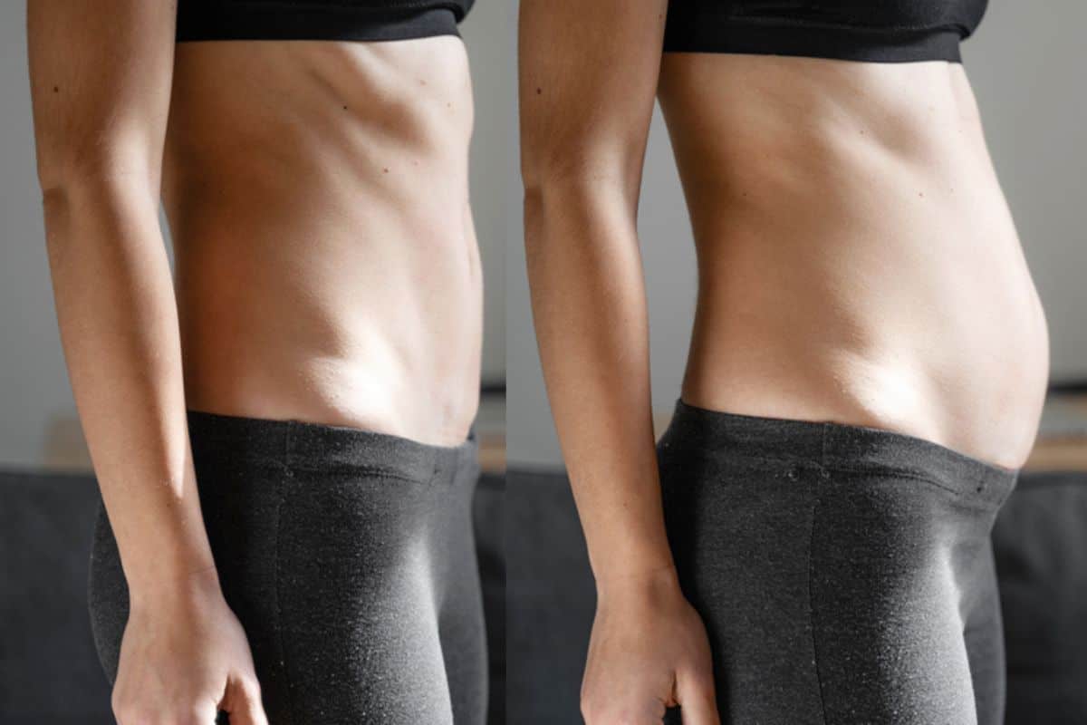 How long does diastasis recti take to improve Newcastle upon Tyne?