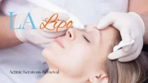 Woman receiving Actinic Keratosis Removal Treatment Newcastle upon Tyne