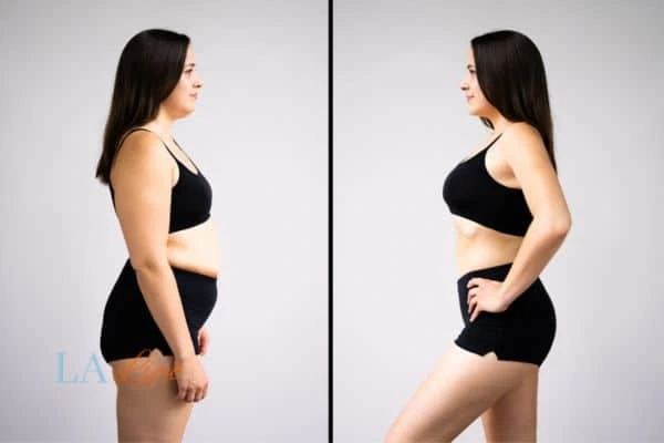 LA-EMS Body Sculpting Newcastle upon Tyne results before and after of womans results on body toning.