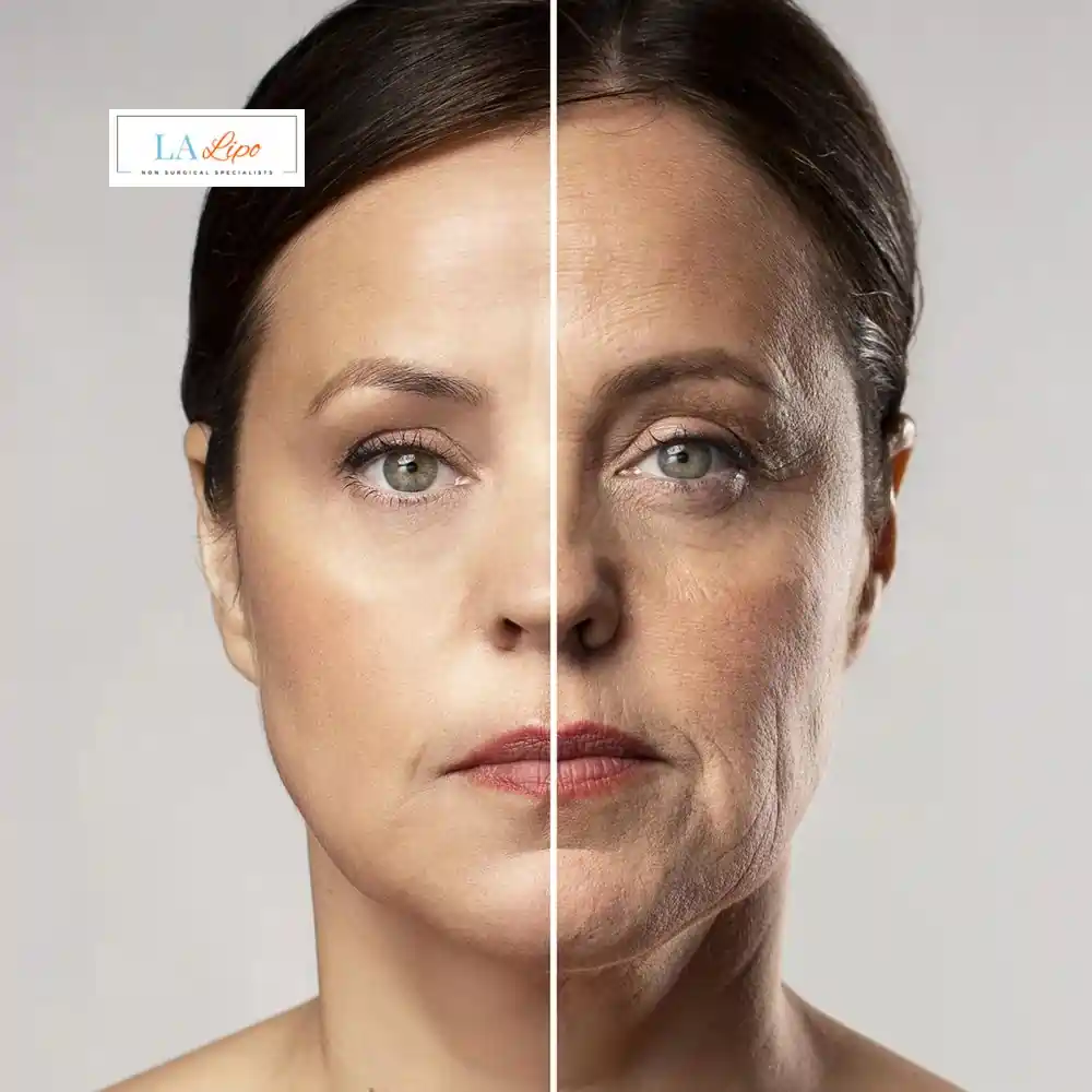 How Can You Tell If Non-Surgical Skin Tightening Is Right for You Newcastle upon Tyne?